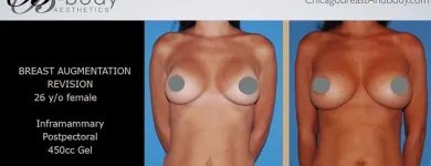 Business 4 image CHICAGO BREAST & BODY AESTHETICS Tattoo Removal in Chicago IL