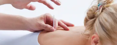 Business 9 image CITY ACUPUNCTURE FULTON STREET Acupuncture in New York NY