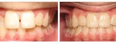Business 4 image CLEAR SMILES Dental Technicians & Laboratories in Dallas TX