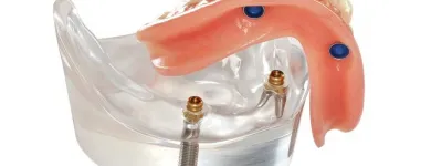 Business 2 image COMFY DENTURE & HEARING Dentists & Dental Clinics in Federal Way WA