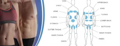 Business 3 image COOLSCULPTING CENTER OF NYC Spa in New York NY