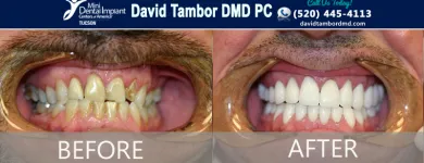 Business 9 image DAVID TAMBOR DMD PC General Dentists in Tucson AZ