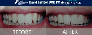 Business 10 image DAVID TAMBOR DMD PC General Dentists in Tucson AZ