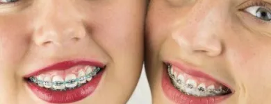 Business 45 image DELGADO ORTHODONTICS Orthodontists in North Richland Hills TX