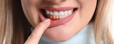 Business 5 image DR RANA BAROUDI - PERIODONTICS AND DENTAL IMPLANTS Medical Dental in San Jose CA