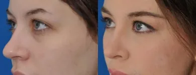 Business 6 image EDWARD S. KWAK MD - ESKMD FACIAL PLASTIC SURGERY Plastic Surgeons in New York NY