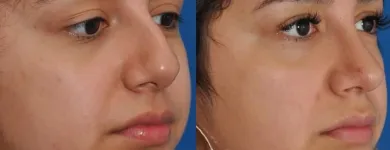 Business 13 image EDWARD S. KWAK MD - ESKMD FACIAL PLASTIC SURGERY Plastic Surgeons in New York NY
