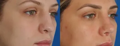 Business 23 image EDWARD S. KWAK MD - ESKMD FACIAL PLASTIC SURGERY Plastic Surgeons in New York NY
