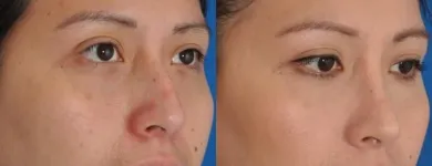 Business 26 image EDWARD S. KWAK MD - ESKMD FACIAL PLASTIC SURGERY Plastic Surgeons in New York NY