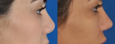 Business 28 image EDWARD S. KWAK MD - ESKMD FACIAL PLASTIC SURGERY Plastic Surgeons in New York NY