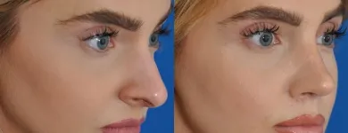 Business 39 image EDWARD S. KWAK MD - ESKMD FACIAL PLASTIC SURGERY Plastic Surgeons in New York NY