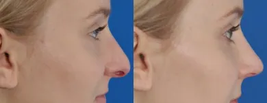 Business 51 image EDWARD S. KWAK MD - ESKMD FACIAL PLASTIC SURGERY Plastic Surgeons in New York NY