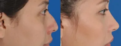 Business 55 image EDWARD S. KWAK MD - ESKMD FACIAL PLASTIC SURGERY Plastic Surgeons in New York NY