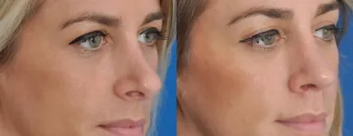 Business 58 image EDWARD S. KWAK MD - ESKMD FACIAL PLASTIC SURGERY Plastic Surgeons in New York NY