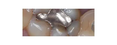 Business 6 image EMERGENCY DENTAL SERVICE MIAMI, FL 33162 Dentists in Miami FL