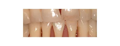 Business 1 image EMERGENCY DENTAL SERVICE MIAMI, FL 33162 Dentists in Miami FL