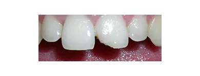 Business 6 image EMERGENCY DENTAL SERVICE ORANGE, CA 92867 Dentists in Orange CA