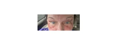 Business 5 image GOLLA CENTER FOR PLASTIC SURGERY AND MEDICAL SPA Plastic Surgery Clinic in Pittsburgh PA
