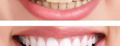 Business 2 image HEALTHY SMILE DENTAL CARE TMJ Treatment in Oakland CA