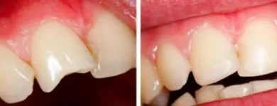 Business 10 image HEALTHY SMILE DENTAL CARE TMJ Treatment in Oakland CA