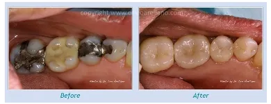 Business 8 image LEO ARELLANO DDS PC Teeth Whitening Products & Services in San Francisco CA