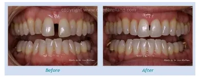 Business 2 image LEO ARELLANO DDS PC Teeth Whitening Products & Services in San Francisco CA