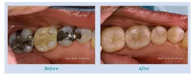 Business 10 image LEO ARELLANO DDS PC Teeth Whitening Products & Services in San Francisco CA