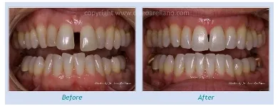Business 3 image LEO ARELLANO DDS PC Teeth Whitening Products & Services in San Francisco CA