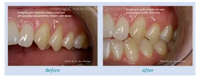 Business 4 image LEO ARELLANO DDS PC Teeth Whitening Products & Services in San Francisco CA