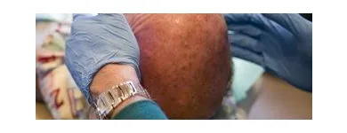 Business 11 image MARTIN TAYLOR DENTISTRY Wisdom Tooth Extraction in Tucson AZ