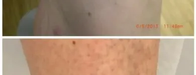 Business 1 image MEDERMIS LASER CLINIC in San Antonio TX