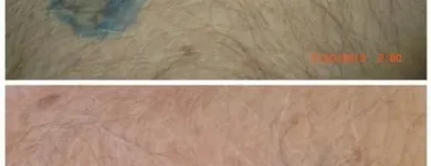 Business 3 image MEDERMIS LASER CLINIC in San Antonio TX