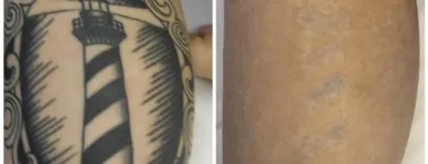 Business 5 image MEDERMIS LASER CLINIC in San Antonio TX