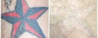 Business 7 image MEDERMIS LASER CLINIC in San Antonio TX