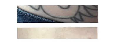 Business 8 image MEDERMIS LASER CLINIC in San Antonio TX