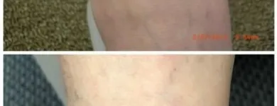 Business 9 image MEDERMIS LASER CLINIC in San Antonio TX