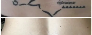 Business 10 image MEDERMIS LASER CLINIC in San Antonio TX