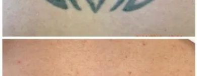 Business 12 image MEDERMIS LASER CLINIC in San Antonio TX