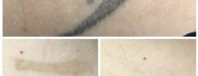 Business 13 image MEDERMIS LASER CLINIC in San Antonio TX