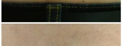 Business 14 image MEDERMIS LASER CLINIC in San Antonio TX