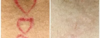 Business 15 image MEDERMIS LASER CLINIC in San Antonio TX