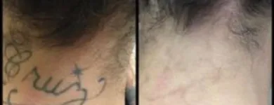 Business 20 image MEDERMIS LASER CLINIC in San Antonio TX