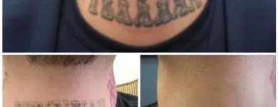 Business 21 image MEDERMIS LASER CLINIC in San Antonio TX