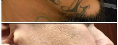 Business 23 image MEDERMIS LASER CLINIC in San Antonio TX