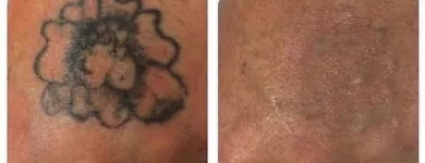 Business 24 image MEDERMIS LASER CLINIC in San Antonio TX