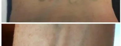 Business 25 image MEDERMIS LASER CLINIC in San Antonio TX