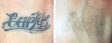 Business 26 image MEDERMIS LASER CLINIC in San Antonio TX