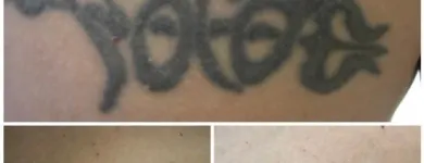 Business 29 image MEDERMIS LASER CLINIC in San Antonio TX