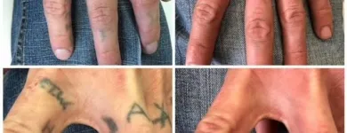 Business 33 image MEDERMIS LASER CLINIC in San Antonio TX