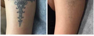 Business 34 image MEDERMIS LASER CLINIC in San Antonio TX